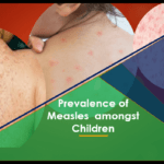 Prevalence of measles among children from 0 - 5 years old