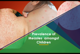 Prevalence Of Measles Amongst Children (0 – 5 Years): Case Study of ABSUTH, Aba
