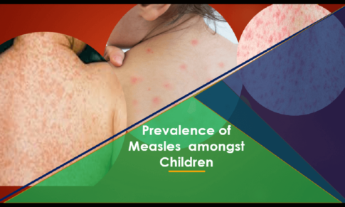 Prevalence Of Measles Amongst Children (0 – 5 Years): Case Study of ABSUTH, Aba